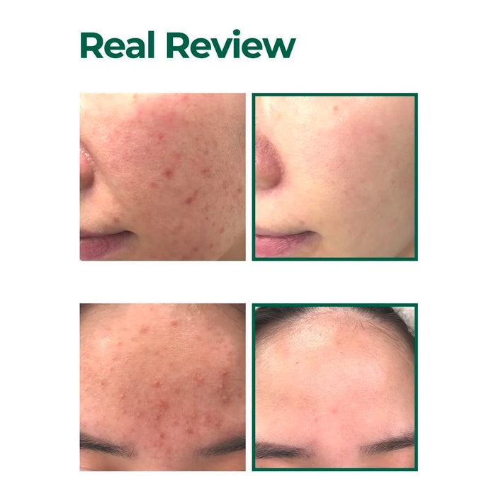 SOME BY MI AHA BHA PHA 30 Days Miracle Serum Light Nudie Glow Australia