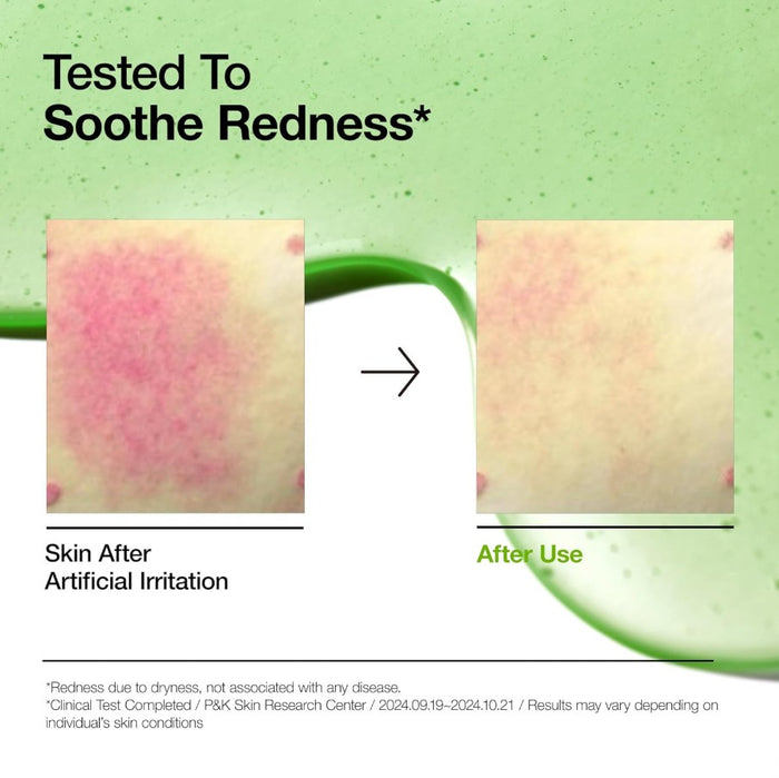 Anua Azelaic Acid 10+ Hyaluron Redness Soothing Serum 30ml, 1.01 fl. oz.