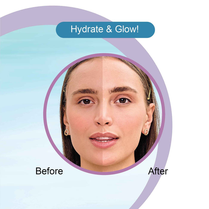 Hyaluronic Gel