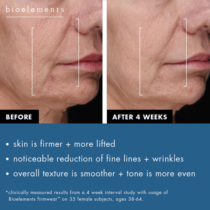 Before and after photos of 4 weeks using Firmwear.  Skin is firmer and more lifted.  Fine lines and wrinkles are reduced.  Overall texture is smoother and skin tone is more even.  Results clinically measured from a 4 week interval study with usage of Bioelements Firmwear on 35 female subjects, ages 38-64.