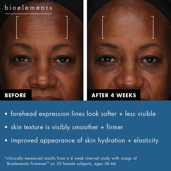 Before and after photos of 4 weeks using Firmwear.  Expression lines on the forehead look softer and less visible. The texture of the skin is visibly smoother and looks firmer.  There is an improved appearance of hydration and elasticity of the skin.  Results clinically measured from a 4 week interval study with usage of Bioelements Firmwear on 35 female subjects, ages 38-64.