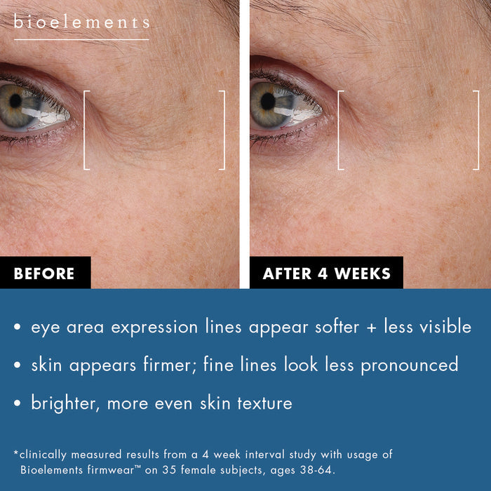 Before and after photos of 4 weeks using Firmwear. Expression lines around the eye area appear softer and less visible. The skin appears firmer with less pronounced fine lines. Skin is brighter and skin texture looks more even. Results clinically measured from a 4 week interval study with usage of Bioelements Firmwear on 35 female subjects, ages 38-64.