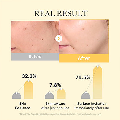 Medicube Kojic Acid Turmeric Brightening Gel Mask 4 Sheets
