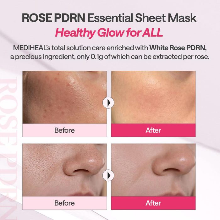 Mediheal Rose PDRN Facial Mask 4pk