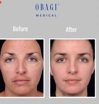 Obagi - C Fx C -Clarifying Skin Brightening Facial Serum With Vitamin C 30ml Obagi