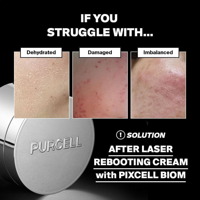 Purcell Biom After Laser Rebooting Cream 50ml