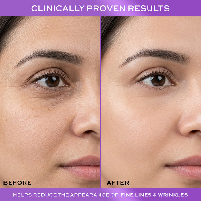 Revolution Pro Miracle Retinoid Refining Night Cream